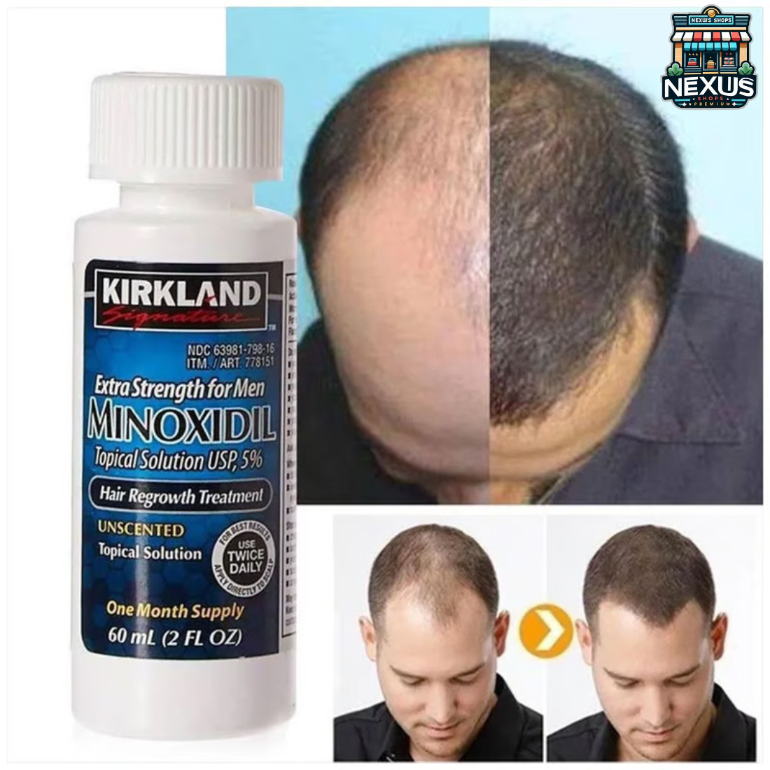 Minoxidil 5%™ ORIGINAL