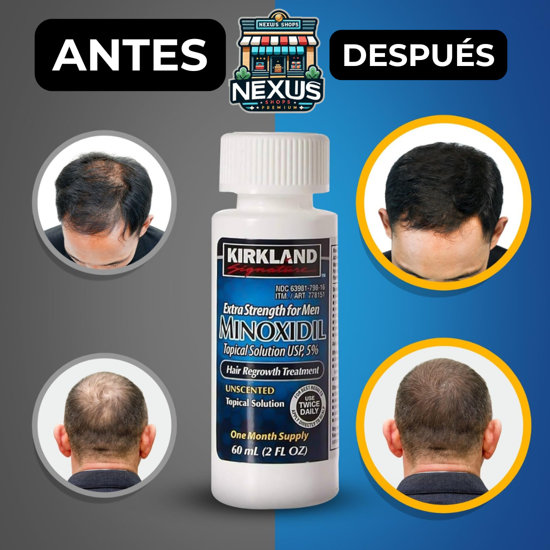 Minoxidil 5%™ ORIGINAL